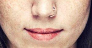 pulled out my nose ring