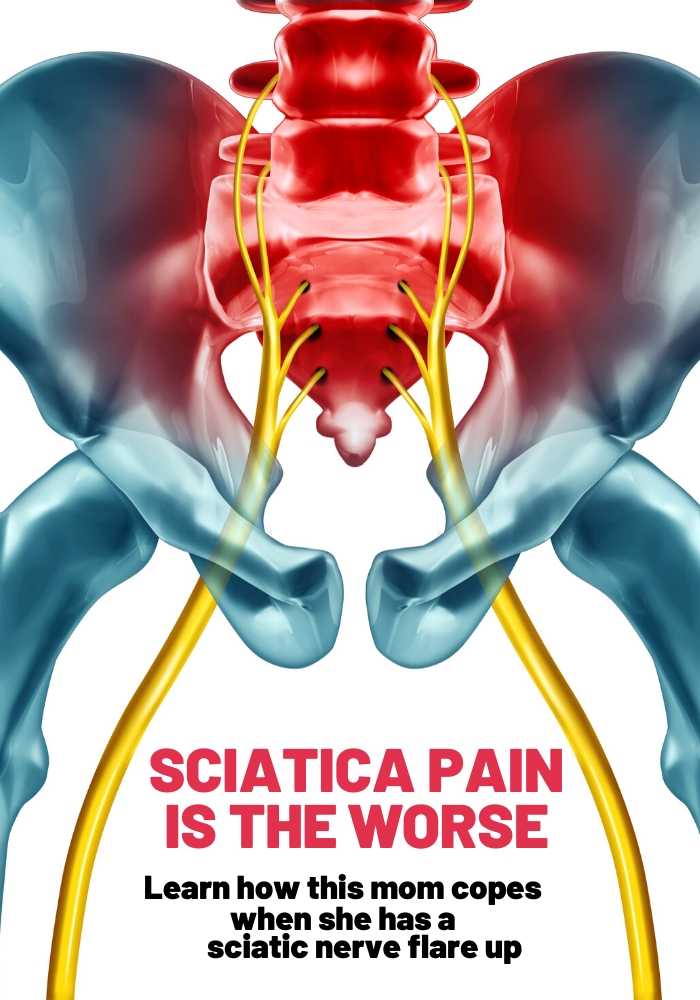 sciatica pain sciatica pain
