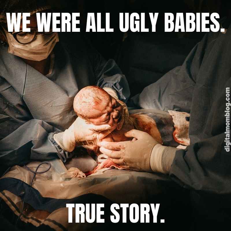 baby ugly meme A newborn baby being held by medical staff with humorous text overlay saying, 'We were all ugly babies. True story,' capturing the essence of relatable baby meme humor.