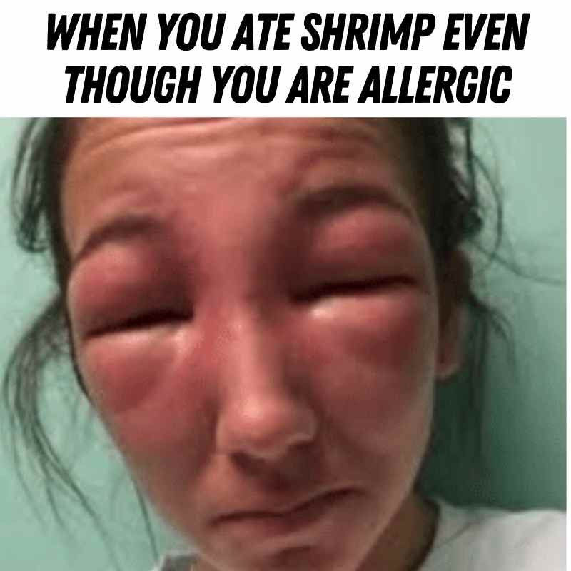 shrimp allergy meme Meme of a person with swollen face and eyes from an allergy reaction after eating shrimp, humorously captioned, "When you ate shrimp even though you are allergic."